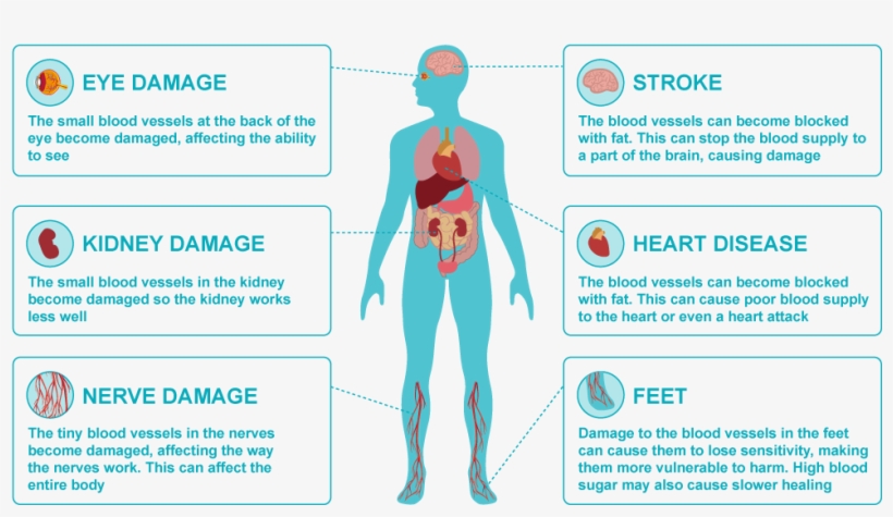Damage Png - Problems Can Diabetes Cause, transparent png download
