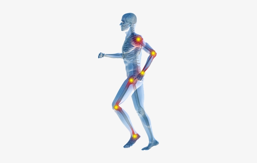 Joint Pain Treatment - Joint, transparent png download