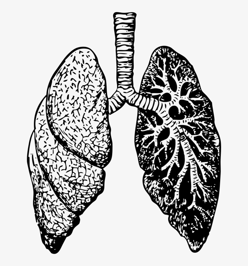 Lung - Dealing With Bronchitis: Overcoming Bronchitis And, transparent png download