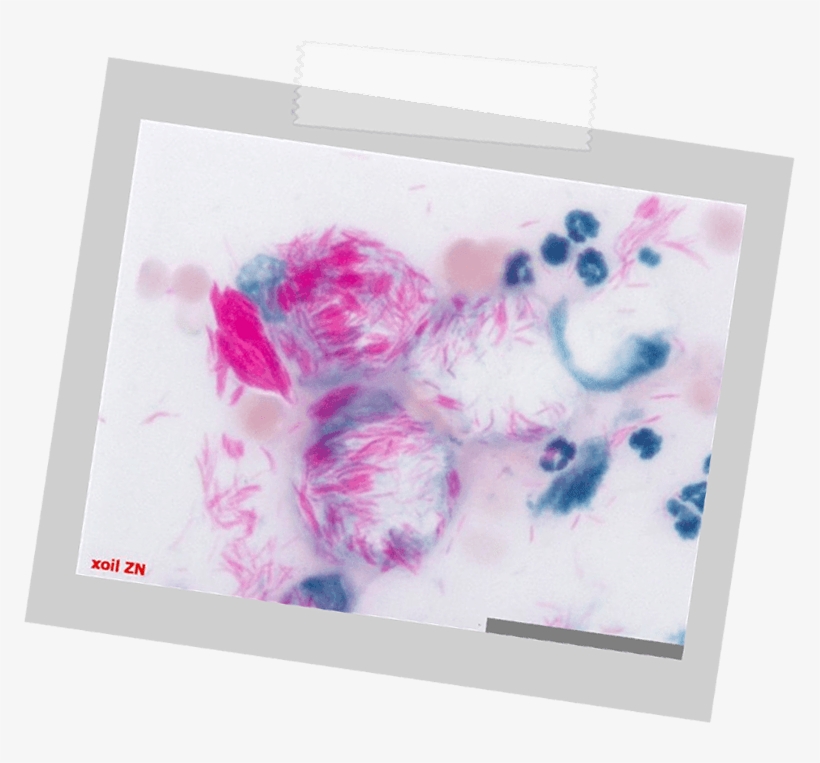 Vet Essentiel Mycovet Spray, transparent png download