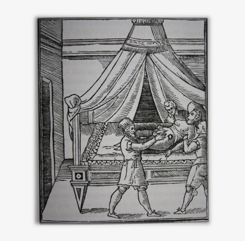 Obs-geronimo Mercurio History Of Caesarean Section, transparent png download