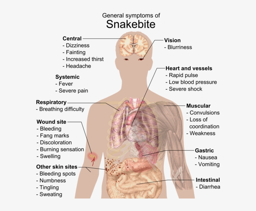 Snake Bite Symptoms - General Symptoms Of Snakebite, transparent png download