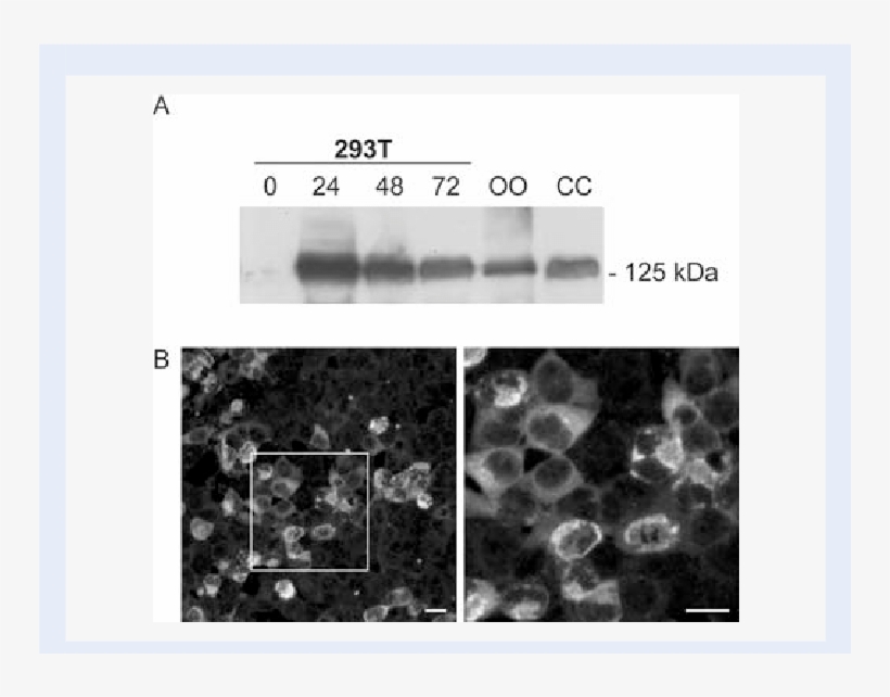 Expression Vector Containing Full-length Mater Was - Hek 293 Cells, transparent png download