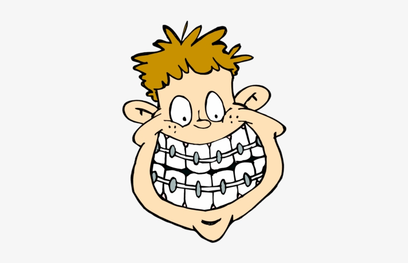 Braces Clipart Clipart Library Library - Brace Clipart, transparent png download