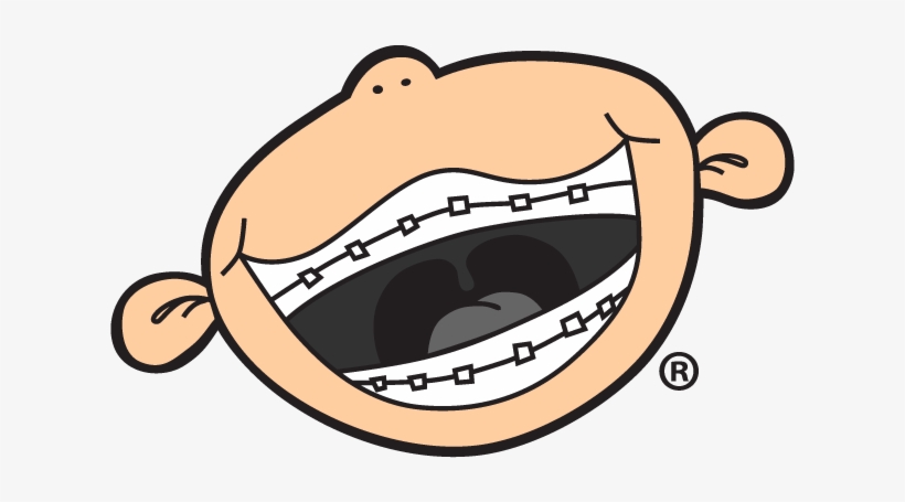 Dental Braces, transparent png download