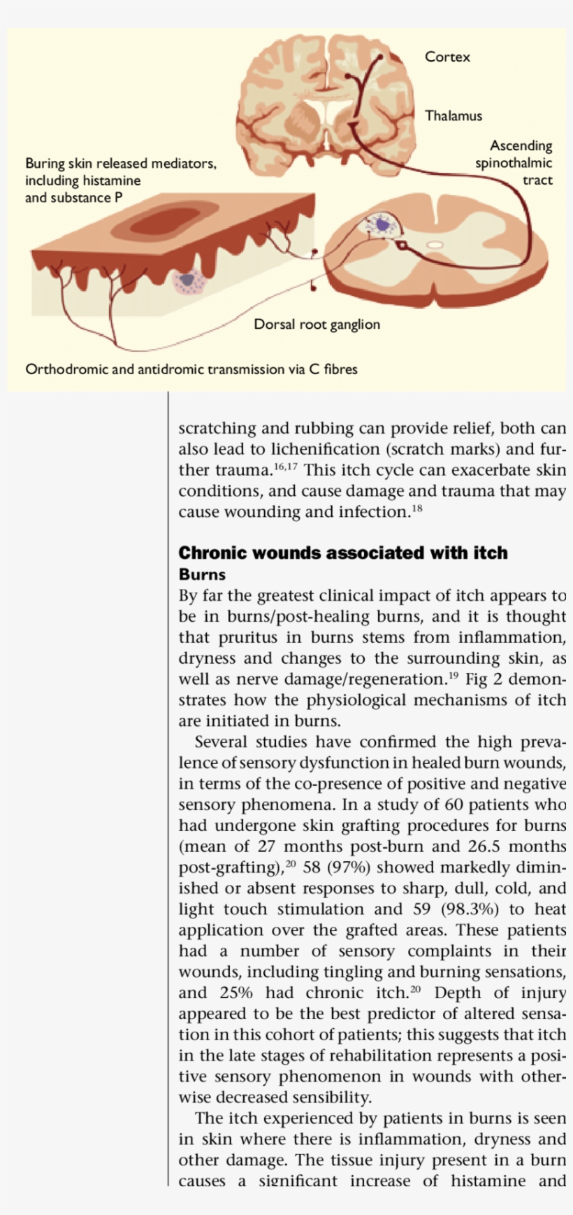 Schematic Diagram Of The Pruritic Pathway - Document, transparent png download
