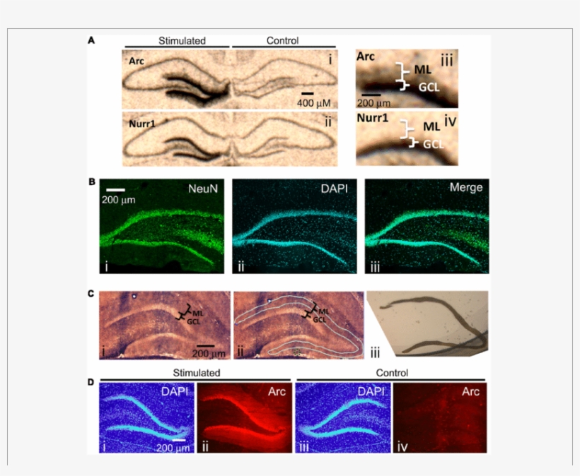 Radioactive In Situ Hybridization Of The Immediate - Immediate Early Gene, transparent png download