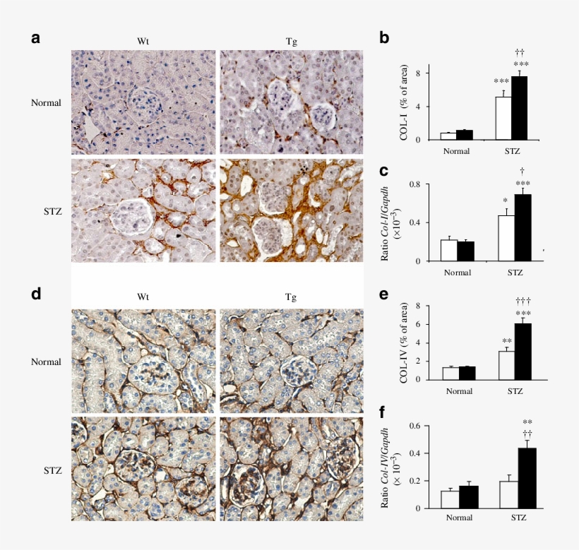 Tg Mice With Diabetes - Collagen, Type I, Alpha 1, transparent png download