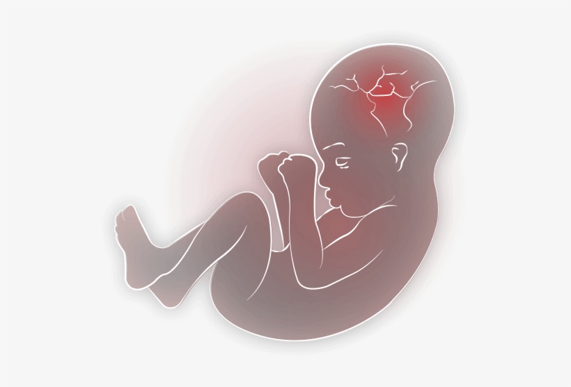 Baby In Womb Png Transparent Baby In Womb - Transparent Baby In Womb, transparent png download