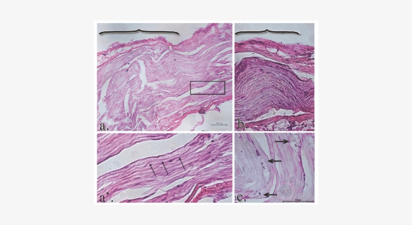 And B - Nerve, transparent png download