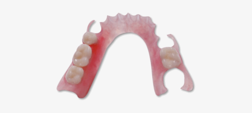 Flexible Partial Dentures - Hillock Family Dental, transparent png download