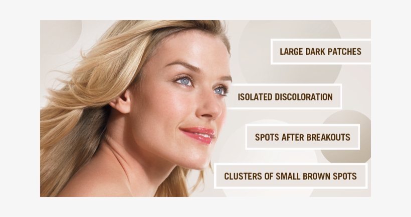 The Different Spots On Your Skin - Remove Melasma On Face, transparent png download