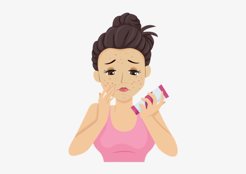 There Are Varying Explanations As To Whether Hormonal - Acne, transparent png download