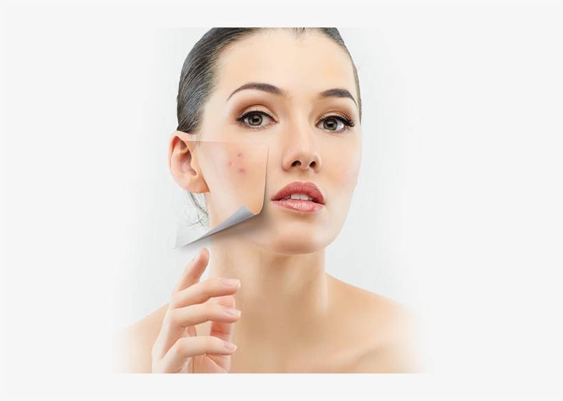 Mysweety Portable Handheld High Frequency Skin Tightening, transparent png download