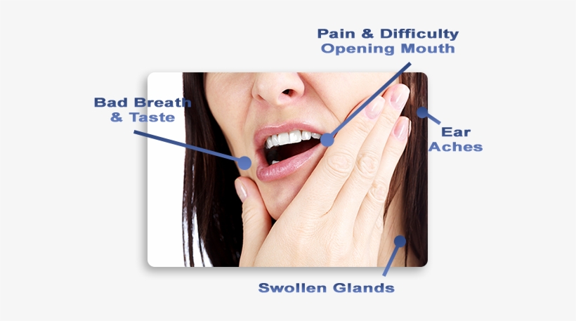 What Are The Wisdom Teeth - Wisdom Tooth Removal Pain, transparent png download