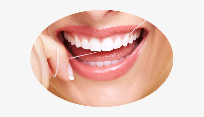 Gum Pockets, Wisdom Teeth And Flossing Floss Regularly - Preventing And Treating Gum Disease, transparent png download