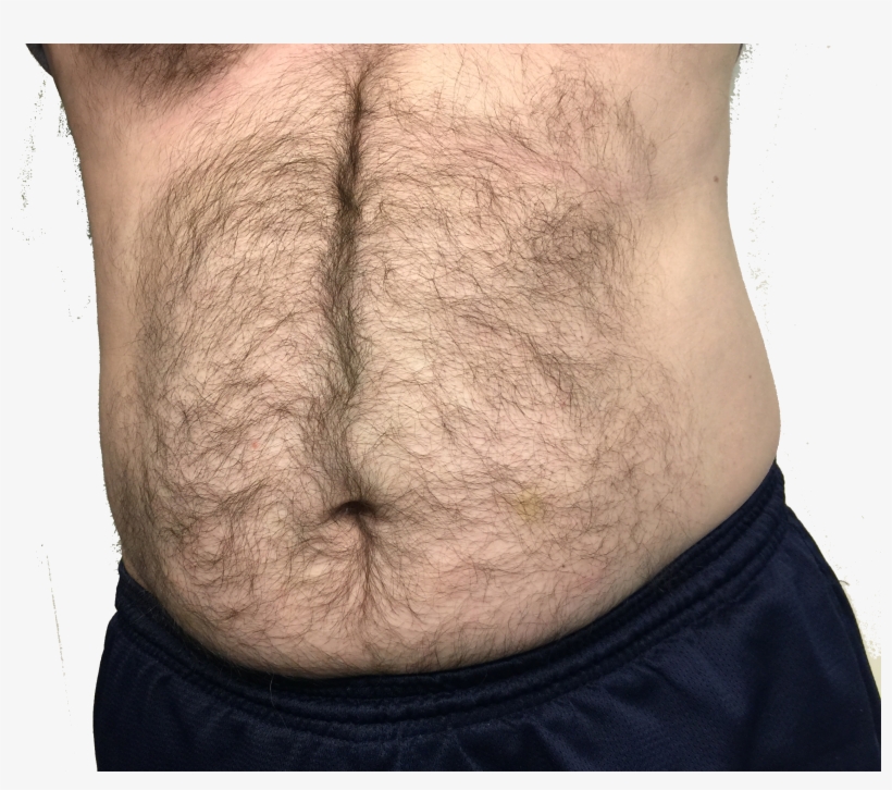 Fat Stomach Png, transparent png download