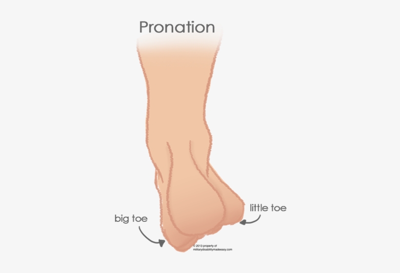 Pronation Of The Foot 3 - Flat Feet Calluses, transparent png download