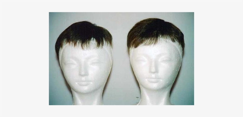 Rm$6000 / Us$1862 - Hair Club For Men, transparent png download