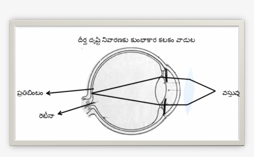 Long Sight-rectification - Diagram, transparent png download