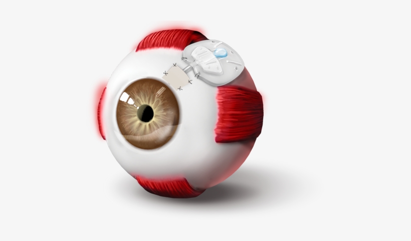 The Valve Is Meant To Close If The Iop Drops Too Low - Stuffed Toy, transparent png download