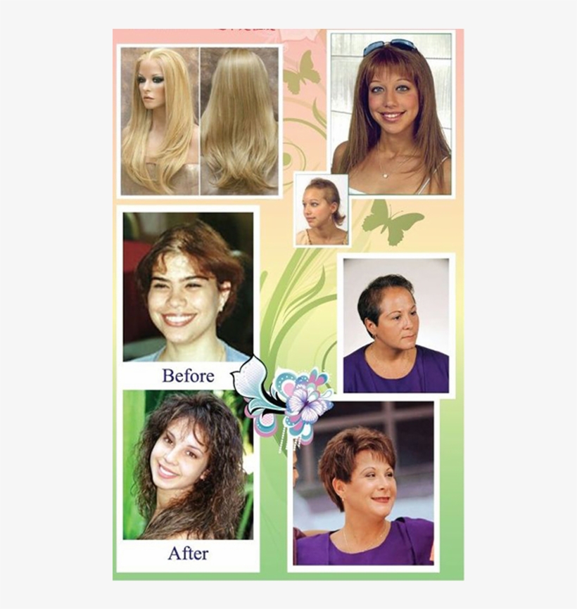 For A Person With Medical Conditions Such As Alopecia, - Full Lace Wigs, transparent png download