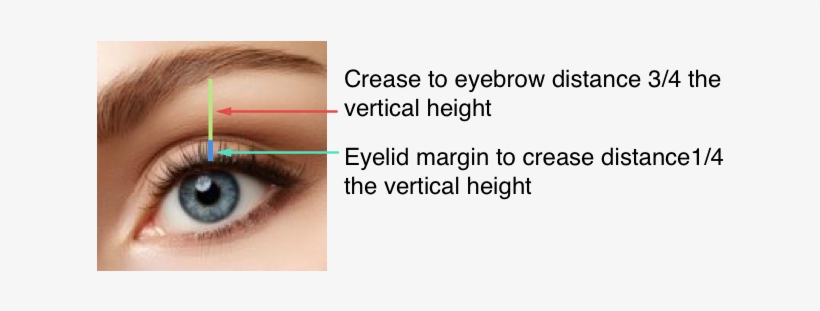 Eye Lift Women Diagram - Eyelid, transparent png download