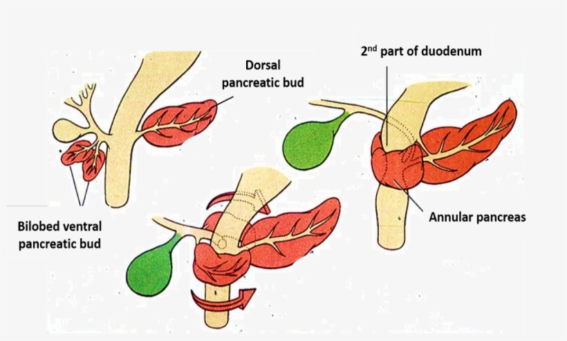 Pancreas - Annular - Dorsal Ventral Pancreatic Buds, transparent png download