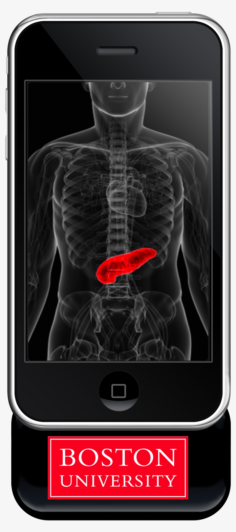 034 Pancreas Phone - Advances In Liver Transplantation [book], transparent png download