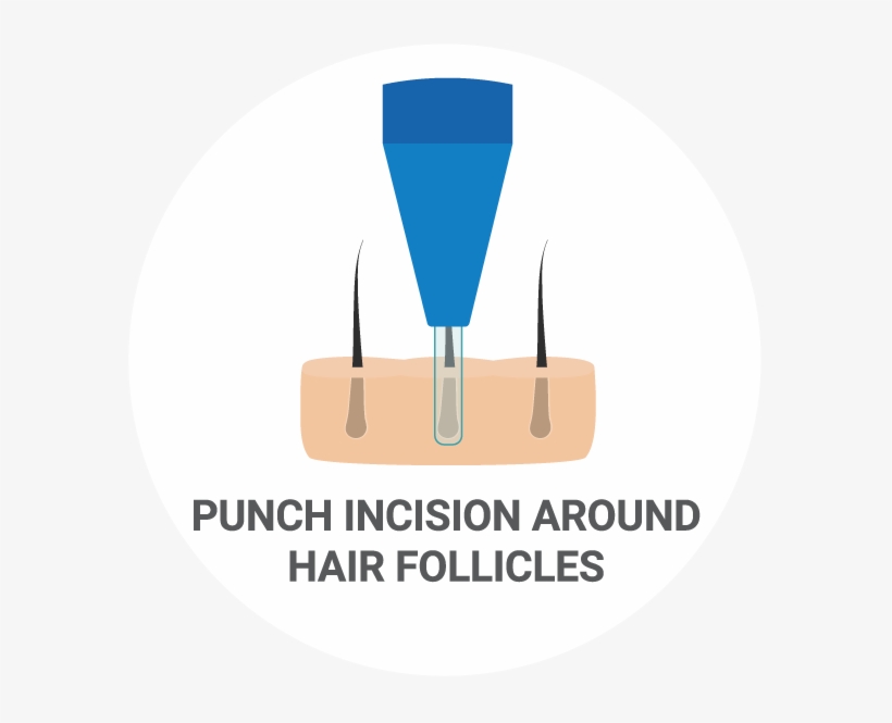 Eyebrow Transplant Procedure - Emblem, transparent png download