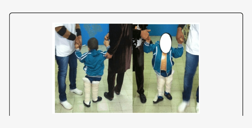 Walking With The Help Of Two People - Walking, transparent png download