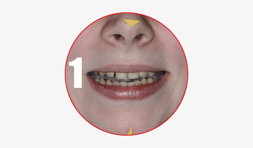 Select A Freebite Air Of Suitable Height - Mouth, transparent png download