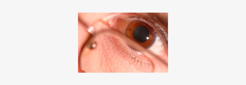 Eyes Pupil Dilation - Mydriasis, transparent png download