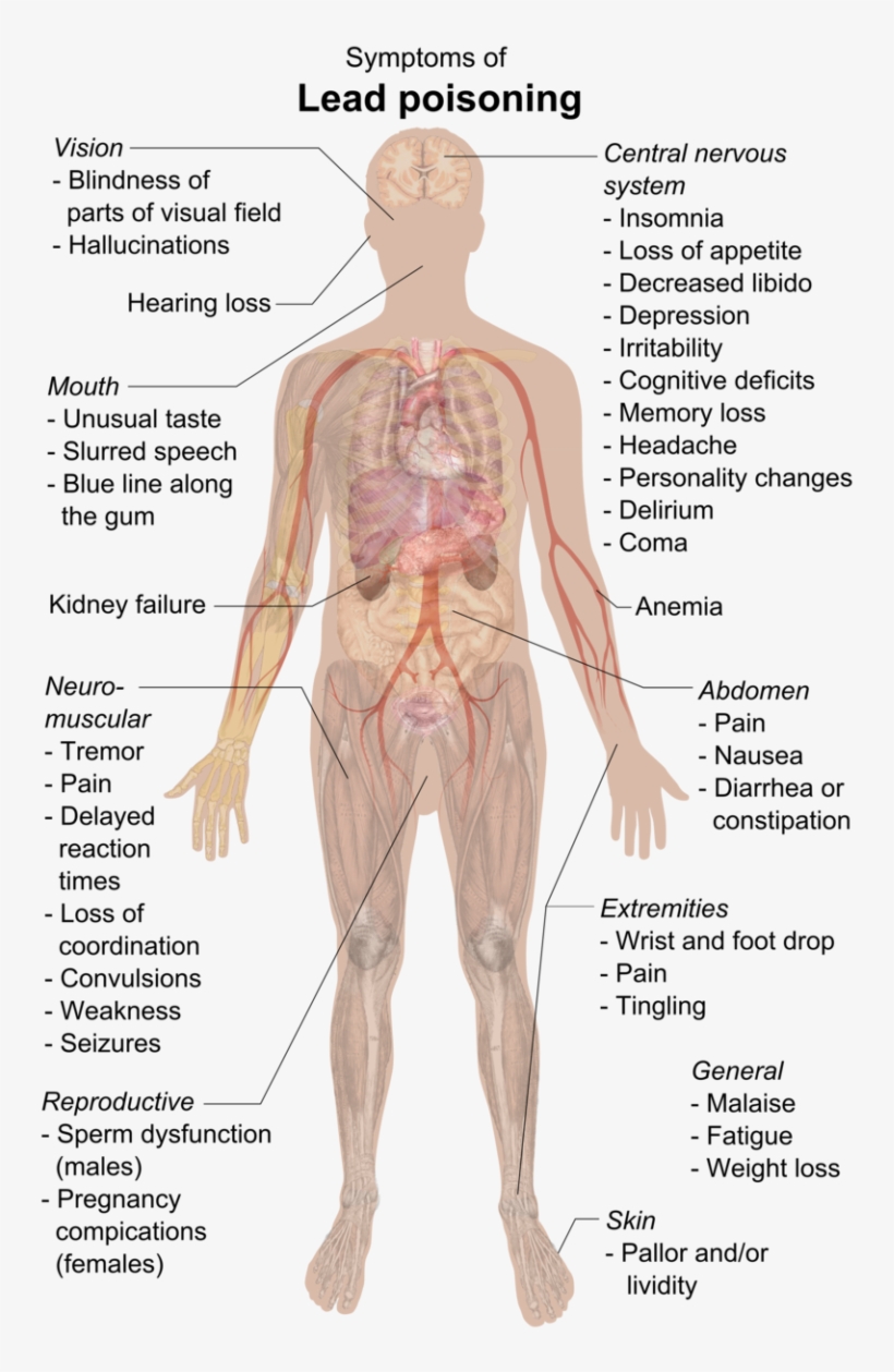Center Nervous System Luxury File Symptoms Of Lead - Lead Poisoning Symptoms, transparent png download
