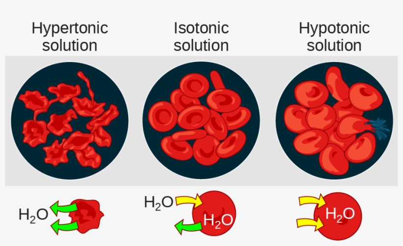 The Left Part Of This Illustration Shows Shriveled - Hypertonic Or Hypotonic, transparent png download
