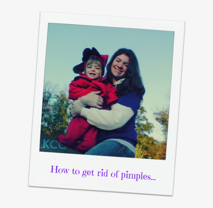 Acne Or Pimple Breakouts Can Occur As Early As Eight - Picture Frame, transparent png download