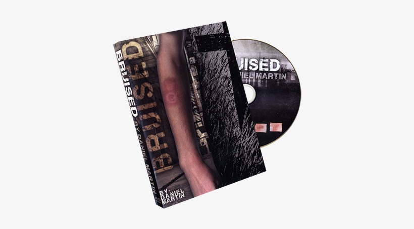 Today, When You Order "bruised By Daniel Martin \ - Mms Bruised By Daniel Martin - Trick, transparent png download