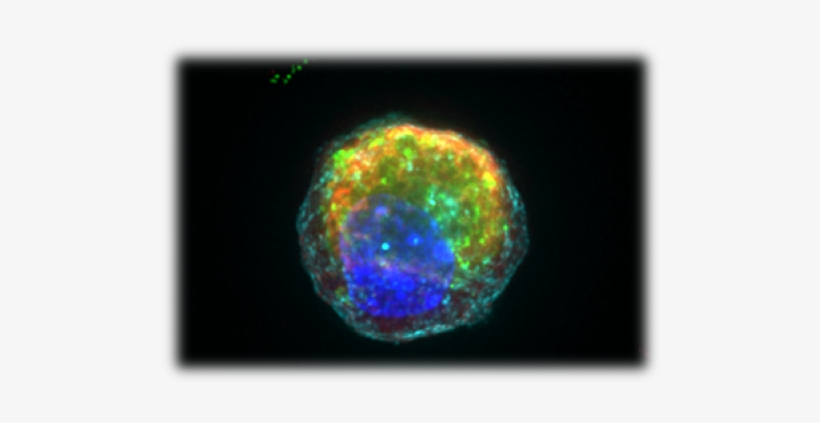 Image Of A Single Paneth Cell With Anti-microbial Granules - Paneth Cell, transparent png download