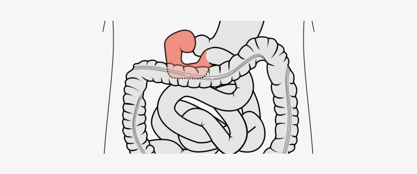 Duodenum Of The Small Intestine Being Squirted, transparent png download