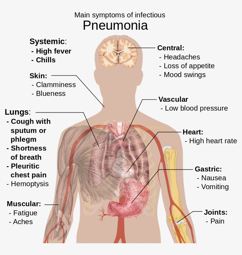 800px-symptoms Of Pneumonia - Pneumonia Sign And Symptom, transparent png download