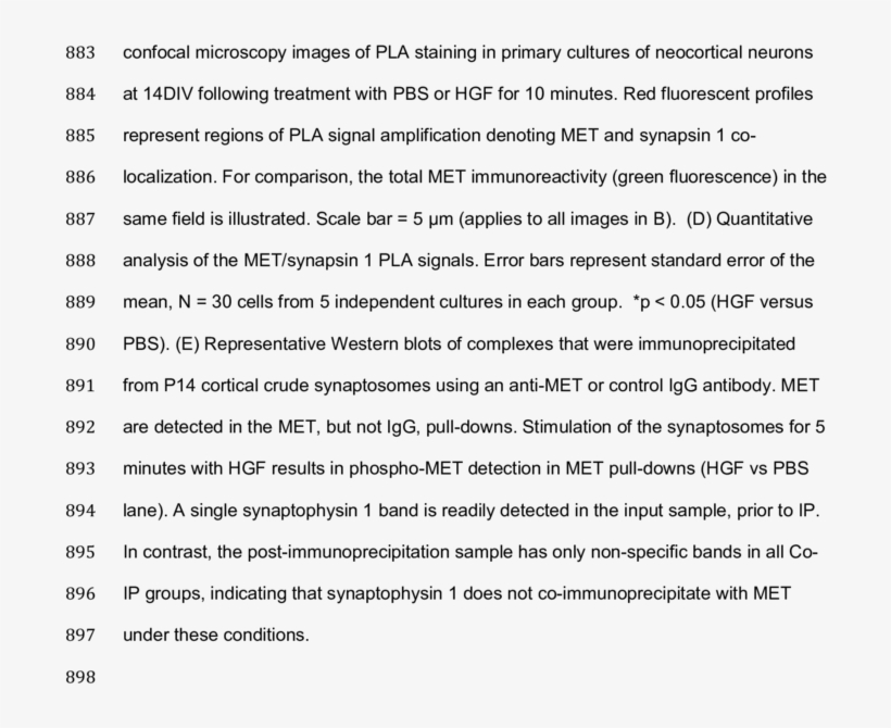 899 Representative Western Blots Of Crude Neocortical - Sorting Algorithm, transparent png download
