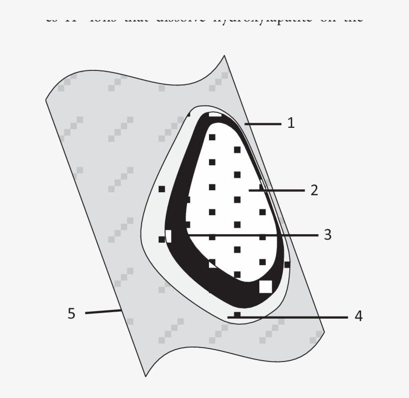 White Carious Spot - Clip Art, transparent png download