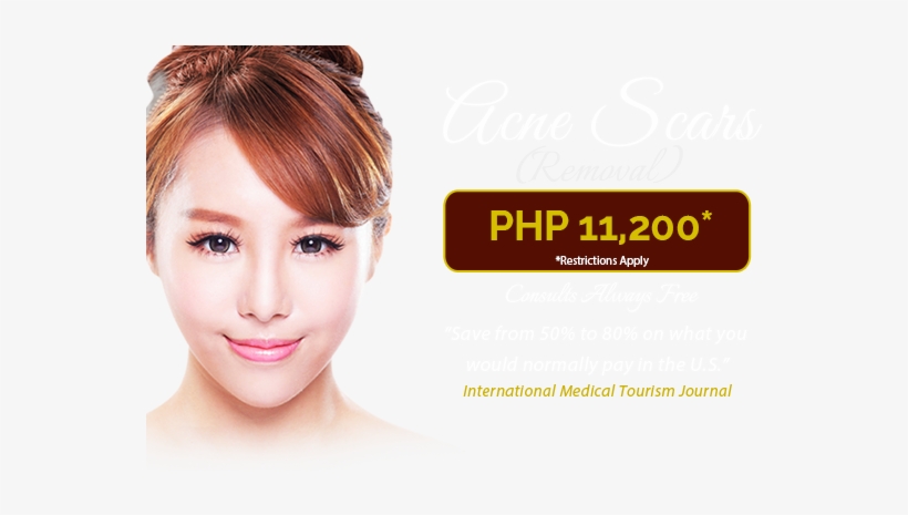 Acne Scar Removal Coupon - Beverly Hills Medical Group, transparent png download
