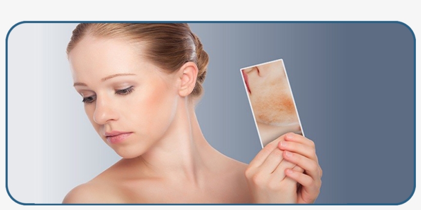 We Aslo Have Owr Own Pharmacy Where We Are Provideing - Serrapeptase Scar Tissue, transparent png download