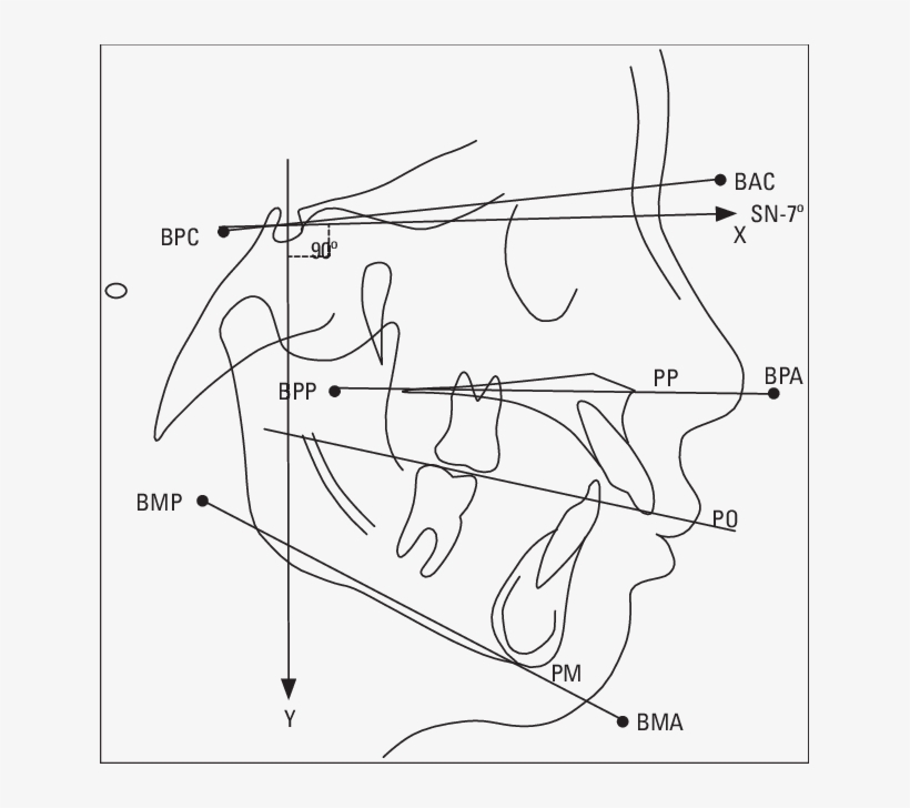 Pontos Fiduciais, Planos E Linhas Cefalométricas - Planos Cefalométricos, transparent png download