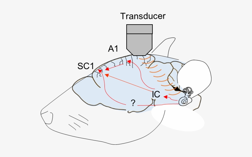 Hongsun Img1 - Modulated Ultrasound, transparent png download