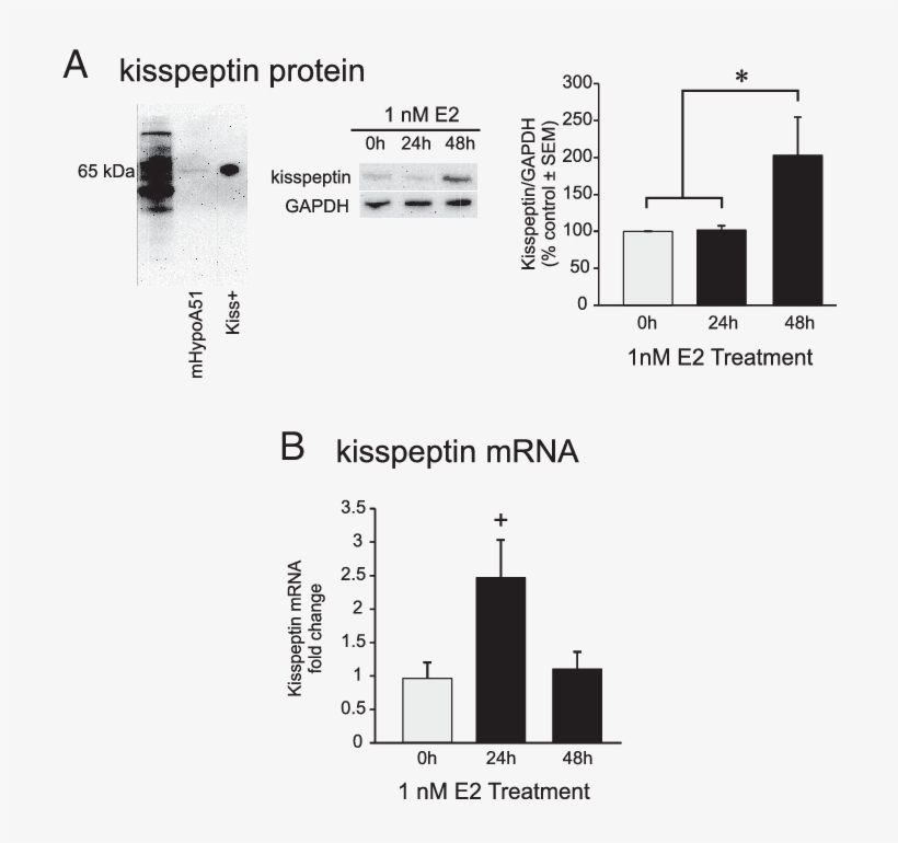 E2 Induces Kisspeptin In Mhypoa51 Neurons - Kisspeptin, transparent png download