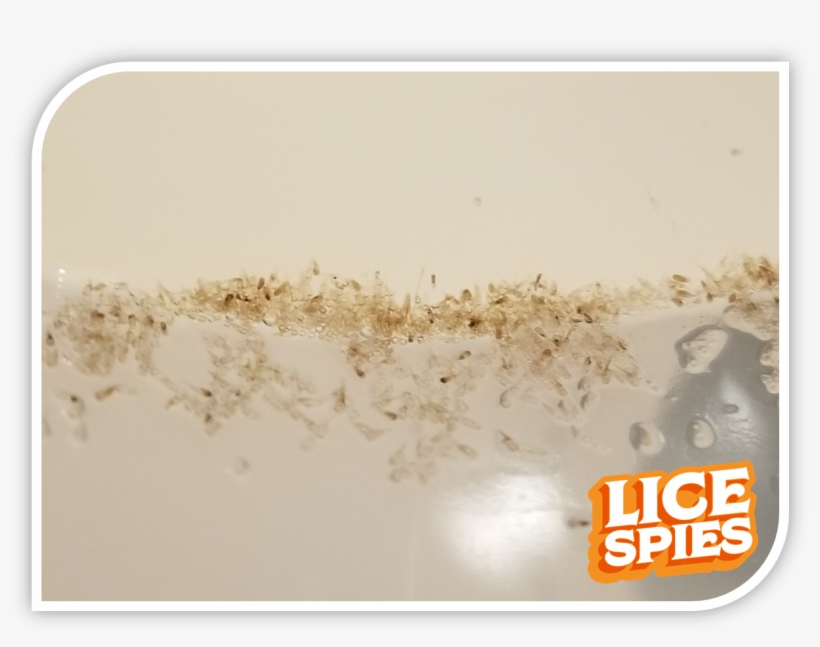 Lice Spies 6 Month Battle Png - Head Lice 2018, transparent png download