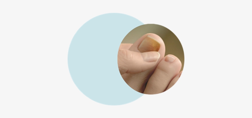 Varpaan Kynnen Alla Valkoista, transparent png download