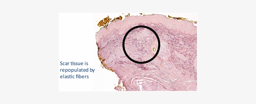 (b) (c) - Torte, transparent png download